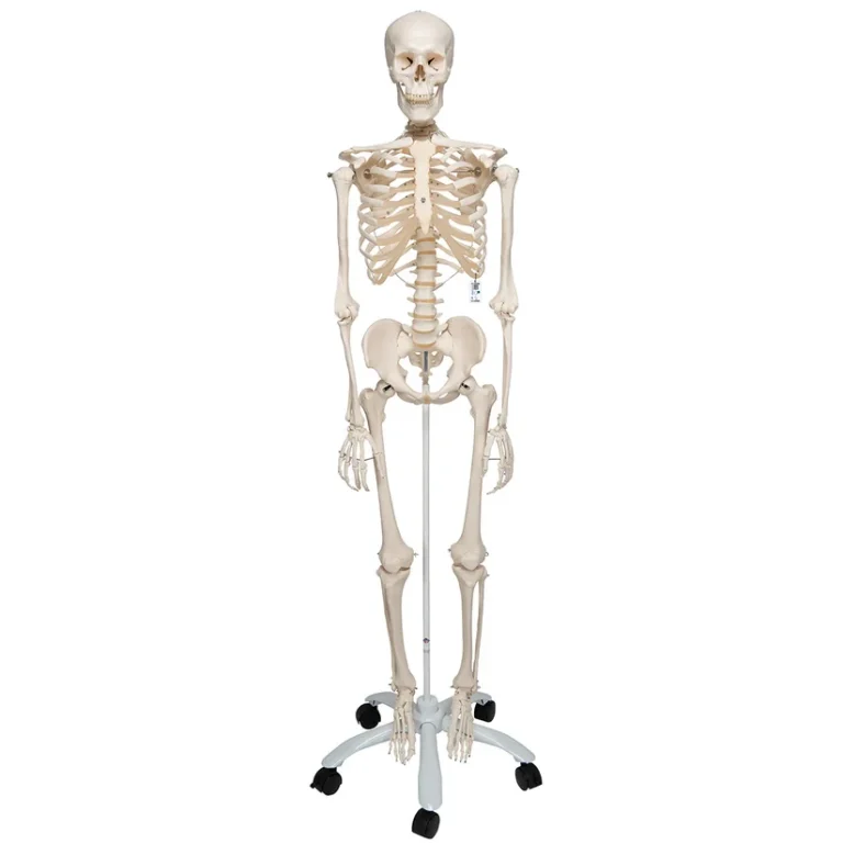 Extra robust skelettmodell